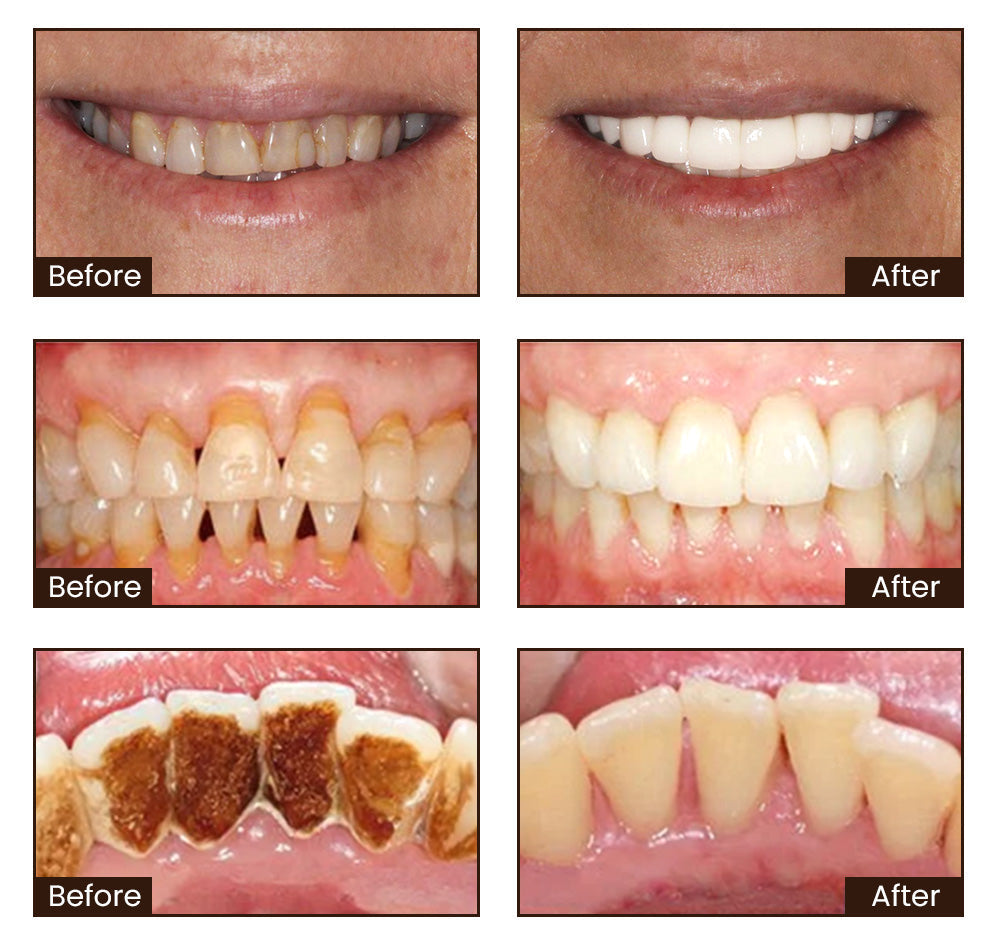 NiacinamideWhiteningToothpaste
