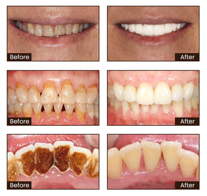 NiacinamideWhiteningToothpaste