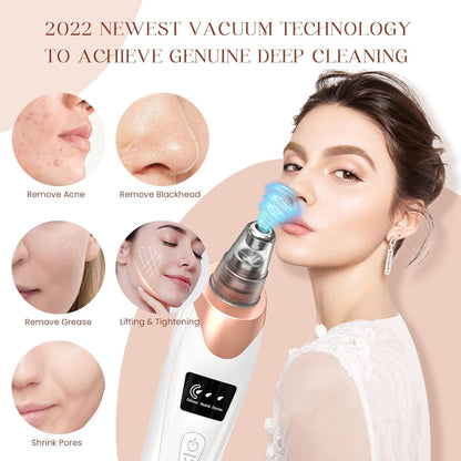 🔥2025 Blackhead Remover Pore Vacuum,Facial Pore Cleaner-5 Suction Power,5 Probes,USB Rechargeable Blackhead Vacuum Kit Electric🔥🔥